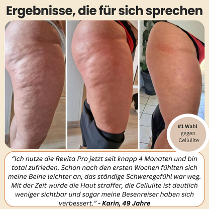 REVITA PRO - Die Kompressions-Leggings mit Kalorien-Boost & Hautstraffung