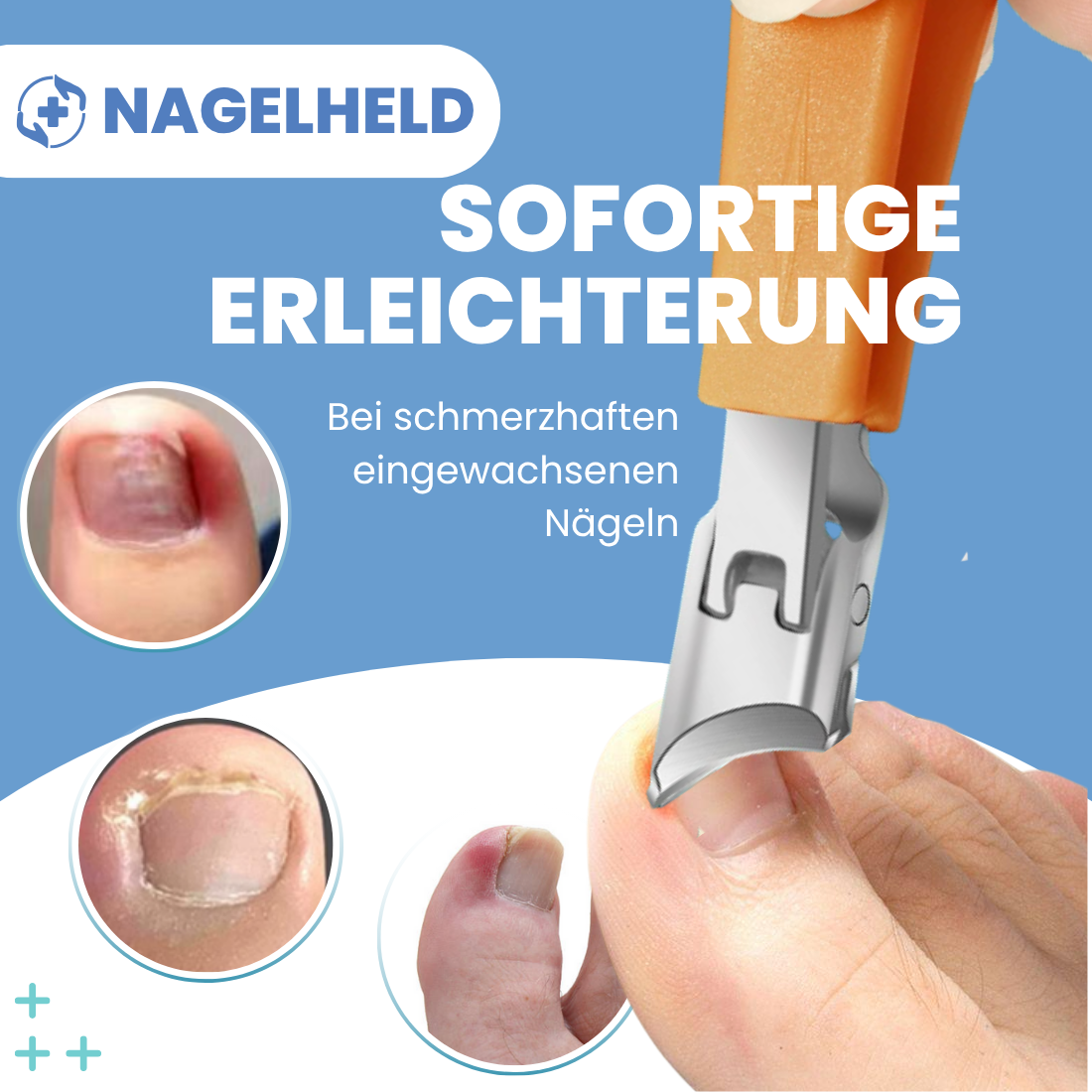 NAGELHELD - Nagelknipser für eingewachsene Nägel