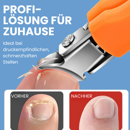 NAGELHELD - Nagelknipser für eingewachsene Nägel